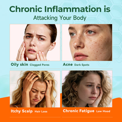 NYO3® 97% Anti-inflammation Salmon Oil Softgels
